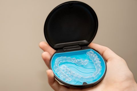 Invisalign